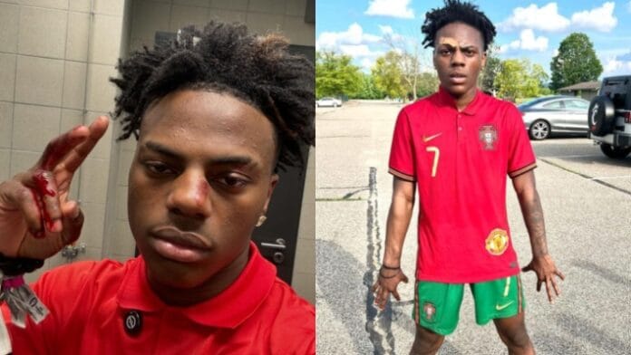 MixCollage-16-Oct-2024-12-11-PM-2854 IShowSpeed